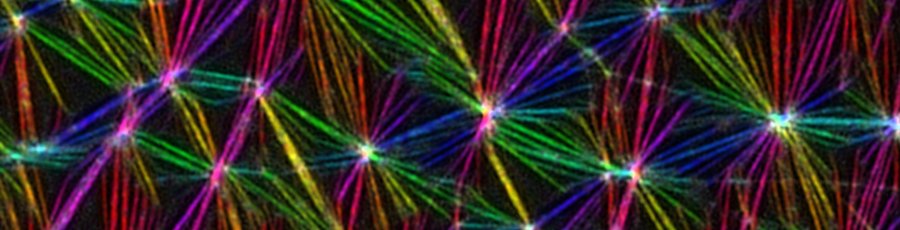 Super-resolution image of an actin network, colour indicates filament orientation